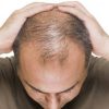 টাক মাথায় চুল গজায় ১০০%-Dexe Hair Lotion Anti Hair Loss-UK. image 2