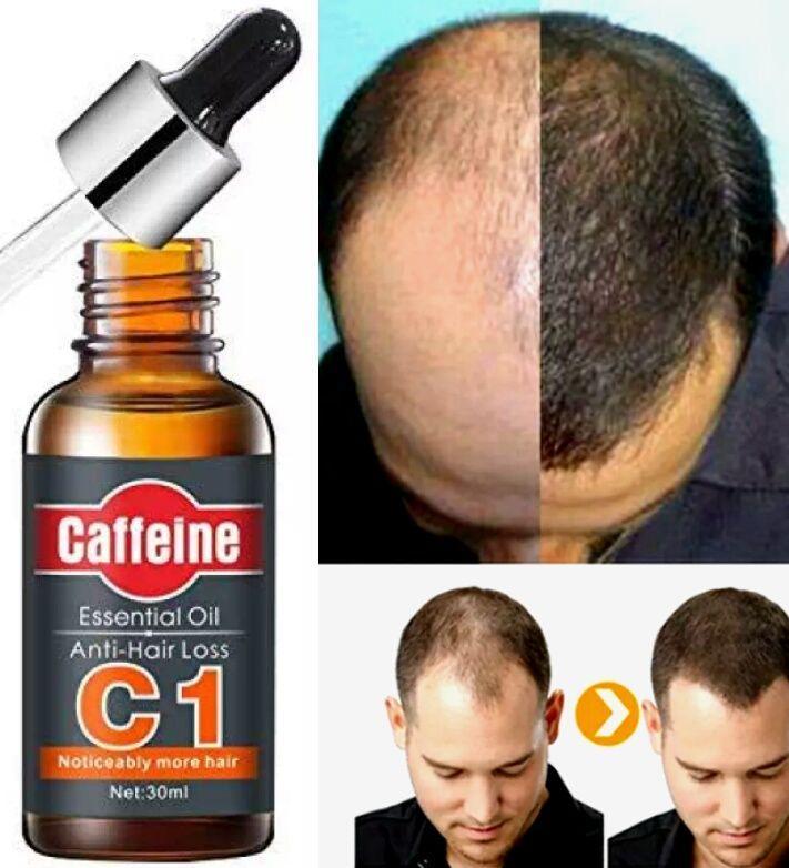 চুল পড়া বন্ধ ও নতুন চুল গজায়-Caffeine Essential Oil Anti Hair Loss-UK. image 2