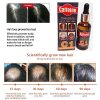 চুল পড়া বন্ধ ও নতুন চুল গজায়-Caffeine Essential Oil Anti Hair Loss-UK. image 5