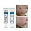 ব্রনের দাগ দূর করে 100% Orginal-Bioaqua Acne Spot Born Out. image 4